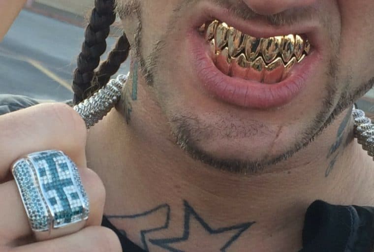 Bitcoin Gold Hacked for $18 Million