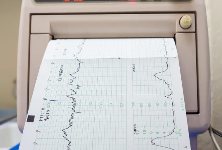 How to Monitor the BCH Stress Test and Get Involved